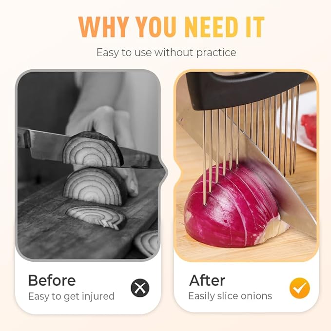 Stainless Steel Onion Slice Holder, Onion Holder for Slicing, Egg Cutter Vegetable Chopper, Ultifunctiona Fruit Slicer OnionPin Slicer Loose Meat Pin, Kitchen Chopper Slicing Tool (2, D)